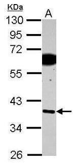 SDF4 Antibody in Western Blot (WB)