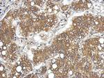 LCN15 Antibody in Immunohistochemistry (Paraffin) (IHC (P))