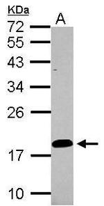 LCN15 Antibody in Western Blot (WB)