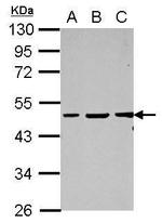 Vasculin Antibody in Western Blot (WB)