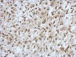 SAP130 Antibody in Immunohistochemistry (Paraffin) (IHC (P))