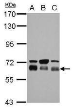 TBC1D22A Antibody in Western Blot (WB)