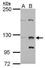 ZFAT Antibody in Western Blot (WB)