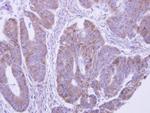 LACTB2 Antibody in Immunohistochemistry (Paraffin) (IHC (P))