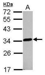 LACTB2 Antibody in Western Blot (WB)