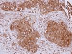 STUB1 Antibody in Immunohistochemistry (Paraffin) (IHC (P))