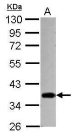 STUB1 Antibody in Western Blot (WB)