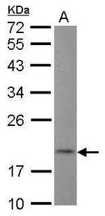 NT5C Antibody in Western Blot (WB)
