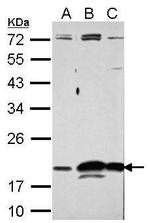 RNase11 Antibody in Western Blot (WB)