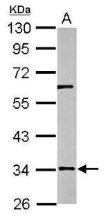 RPUSD3 Antibody in Western Blot (WB)