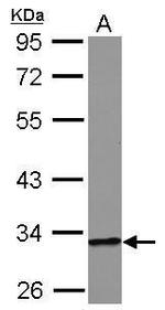 HIBADH Antibody in Western Blot (WB)