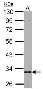 HIBADH Antibody in Western Blot (WB)