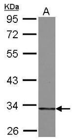 HIBADH Antibody in Western Blot (WB)