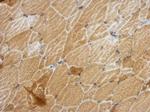 ANKRD53 Antibody in Immunohistochemistry (Paraffin) (IHC (P))