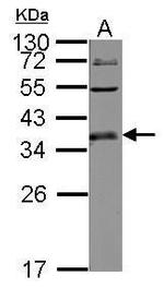 ULBP1 Antibody in Western Blot (WB)