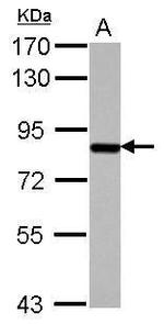 SUPV3L1 Antibody in Western Blot (WB)