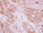 Atpalpha Antibody in Immunohistochemistry (Paraffin) (IHC (P))