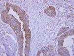 SLA/LP Antibody in Immunohistochemistry (Paraffin) (IHC (P))