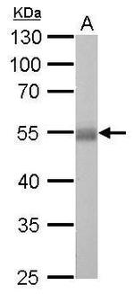 ALDH1A1 Antibody in Western Blot (WB)