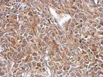 OXSM Antibody in Immunohistochemistry (Paraffin) (IHC (P))