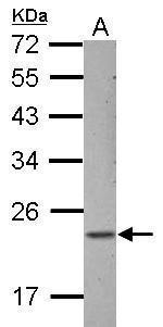 ZNF22 Antibody in Western Blot (WB)