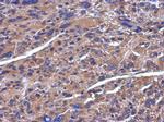 ADAMTS5 Antibody in Immunohistochemistry (Paraffin) (IHC (P))