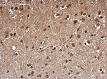 FHL1 Antibody in Immunohistochemistry (Paraffin) (IHC (P))