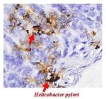 Helicobacter pylori Urease B Antibody in Immunohistochemistry (Paraffin) (IHC (P))