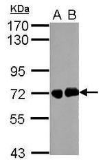 Helicobacter pylori Urease B Antibody in Western Blot (WB)