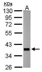 nrv2 Antibody in Western Blot (WB)