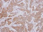 ZPK Antibody in Immunohistochemistry (Paraffin) (IHC (P))