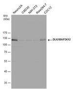 ZPK Antibody in Western Blot (WB)