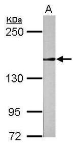 RAD50 Antibody in Western Blot (WB)