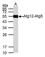 ATG12 Antibody in Western Blot (WB)