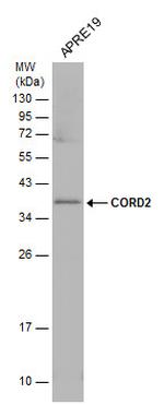 CRX Antibody in Western Blot (WB)