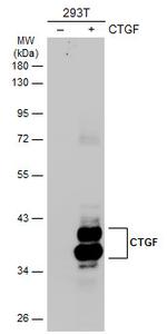CTGF Antibody in Western Blot (WB)