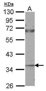 CTGF Antibody in Western Blot (WB)