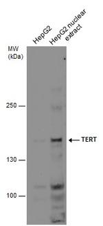 TERT Antibody in Western Blot (WB)