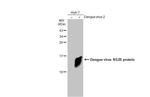 Dengue Virus Type 2 NS2B Antibody in Western Blot (WB)