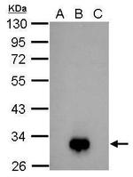 Dengue Virus Type 2 NS4B Antibody in Western Blot (WB)