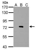 Dengue Virus Type 2 NS3 Antibody in Western Blot (WB)