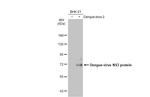 Dengue Virus Type 2 NS3 Antibody in Western Blot (WB)