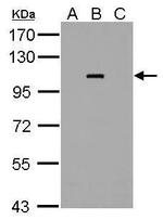 Dengue Virus Type 2 NS5 Antibody in Western Blot (WB)