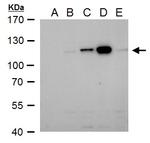 Dengue Virus Type 2 NS5 Antibody in Western Blot (WB)