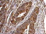 Bcl-xS Antibody in Immunohistochemistry (Paraffin) (IHC (P))