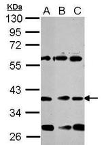 NeuroD1 Antibody in Western Blot (WB)