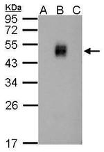 Dengue Virus Type 2 NS1 Antibody in Western Blot (WB)