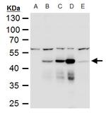 Dengue Virus Type 2 NS1 Antibody in Western Blot (WB)