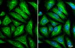 GEF-H1 Antibody in Immunocytochemistry (ICC/IF)