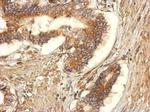 GEF-H1 Antibody in Immunohistochemistry (Paraffin) (IHC (P))